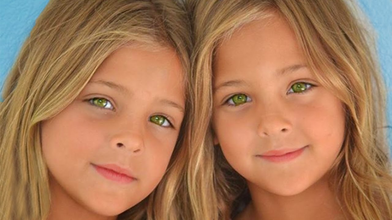 These Twins Were Named Most Beau 