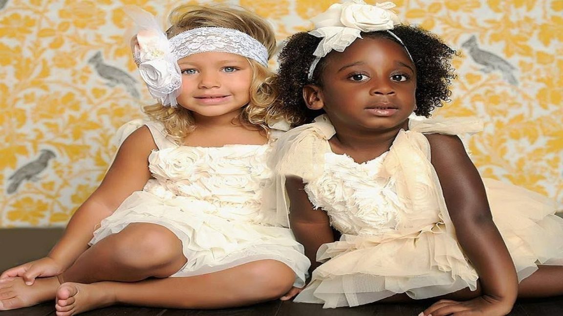 Mom’s Twins Born Different Colors. 18 Years After, This Is What They ...